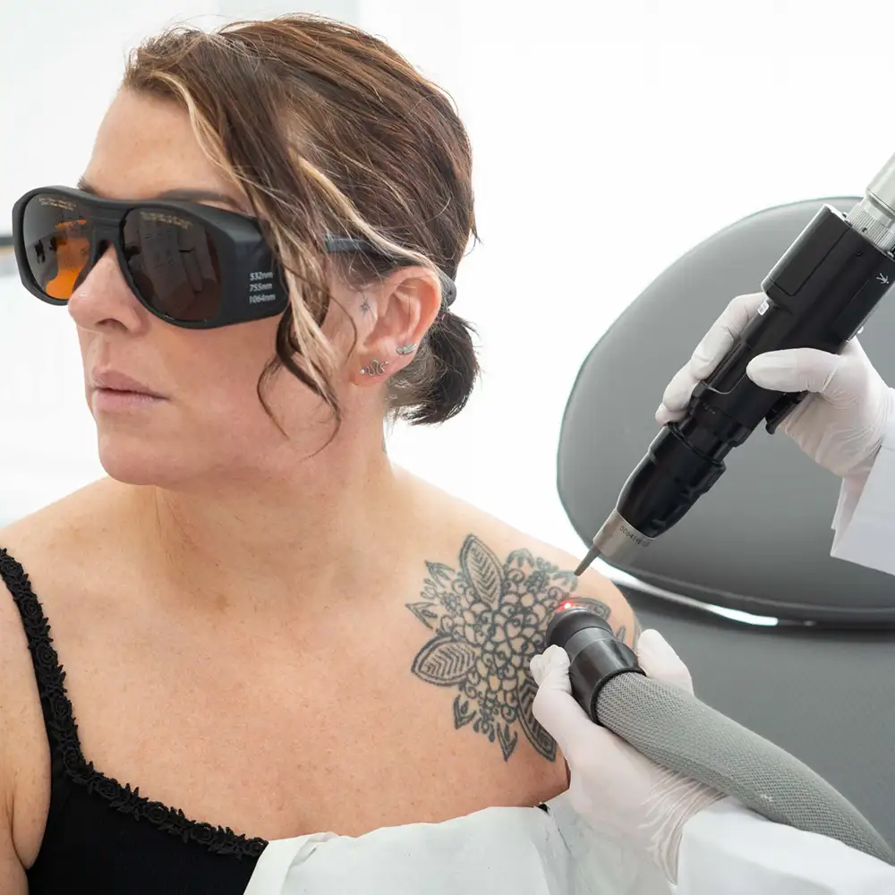 Understanding the Technology Behind Laser Tattoo Removal